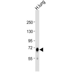 Alpha-L-Iduronidase (IDUA) Antibody