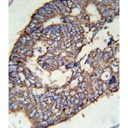 Solute Carrier Family 47 Member 1 (SLC47A1) Antibody