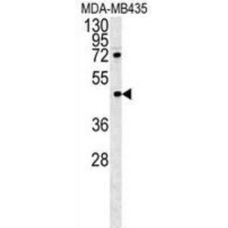 PYHIN1 Antibody