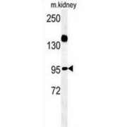 WB analysis of Mouse kidney tissue lysate (35 µg/ml), using ARMC5 antibody.