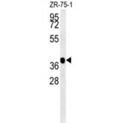 NIPA-Like Protein 2 (NIPAL2) Antibody