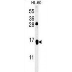 Early Activation Antigen CD69 (CD69) Antibody