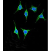 Pancreatic Alpha-Amylase (AMY2A) Antibody