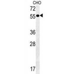 Pancreatic Alpha-Amylase (AMY2A) Antibody