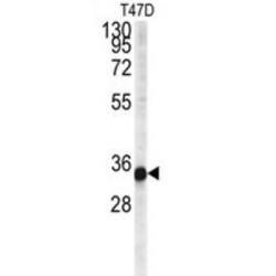 Cardiolipin Synthase (CRLS1) Antibody
