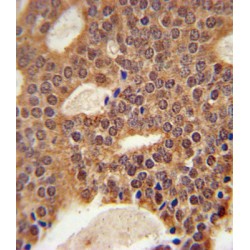 5' Exonuclease Apollo (DCLRE1B) Antibody