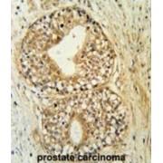 Phospholipid-Transporting ATPase IG (ATP11C) Antibody