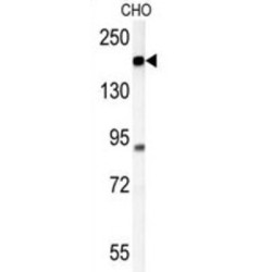 Phospholipid-Transporting ATPase IG (ATP11C) Antibody