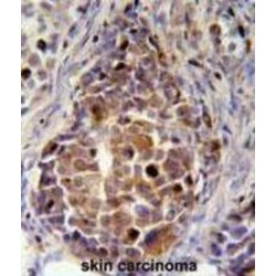 Retinol Dehydrogenase 16 (RDH16) Antibody