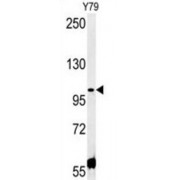 Coiled-Coil Domain-Containing Protein 146 (CCDC146) Antibody