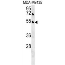 G Kinase Anchoring Protein 1 (GKAP1) Antibody