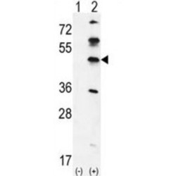 G Kinase Anchoring Protein 1 (GKAP1) Antibody