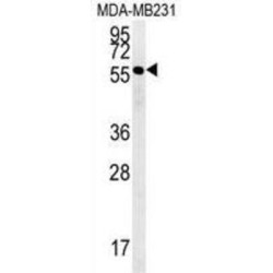 Rab11 Family-Interacting Protein 2 (RAB11FIP2) Antibody
