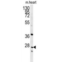 Indolethylamine N-Methyltransferase (INMT) Antibody