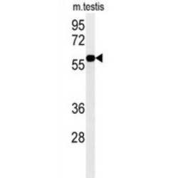 H/ACA Ribonucleoprotein Complex Subunit DKC1 (DKC1) Antibody