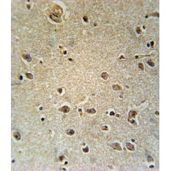 TXTP Antibody