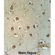 Mitochondrial Carrier 2 (MTCH2) Antibody