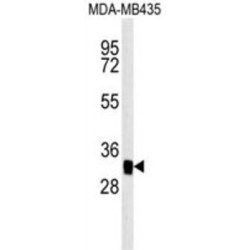 Mitochondrial Carrier 2 (MTCH2) Antibody