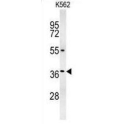 Glucagon-Like Peptide 1 (GLP1) Antibody