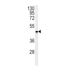 Alcohol Dehydrogenase 1C (Class I), Gamma Polypeptide (ADH1C) Antibody