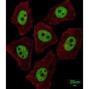 X-Ray Repair Cross Complementing 1 (XRCC1) Antibody