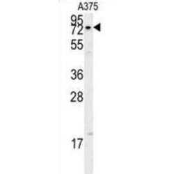 X-Ray Repair Cross Complementing 1 (XRCC1) Antibody