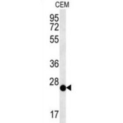 Cysteine Rich Secretory Protein LCCL Domain Containing 2 (CRISPLD2) Antibody