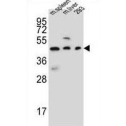 Steap Family Member 2 (STEA2) Antibody