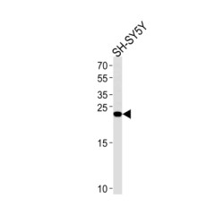 Regenerating Islet Derived Protein 3 Gamma (REG3G) Antibody