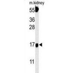 Fibroblast Growth Factor Binding Protein 3 (FGFBP3) Antibody