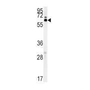Zinc Finger Protein Aiolos (IKZF3) Antibody