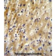 Hyaluronan Binding Protein 2 (HABP2) Antibody