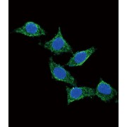 Pituitary Adenylate Cyclase-Activating Polypeptide / PACAP (ADCYAP1) Antibody