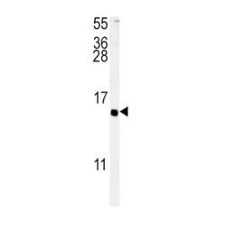 Adenylate Cyclase Activating Polypeptide 1, Pituitary (ADCYAP1) Antibody