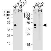 abx032587