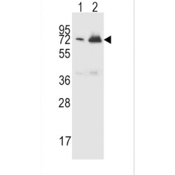 Complement Factor H-Related Protein 5 (CFHR5) Antibody
