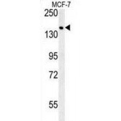 Sterile Alpha Motif Domain Containing 9 (SAMD9) Antibody