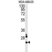 LHFPL Tetraspan Subfamily Member 3 Protein (LHPL3) Antibody