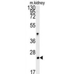 LHFPL Tetraspan Subfamily Member 3 Protein (LHPL3) Antibody