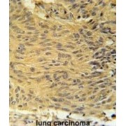 Lysocardiolipin Acyltransferase 1 (LCLAT1) Antibody