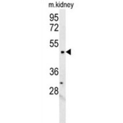 Lysocardiolipin Acyltransferase 1 (LCLAT1) Antibody