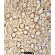 CRUM2 Antibody