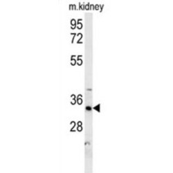 DHB13 Antibody