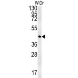 Cyclin-Y-Like Protein 1 (CCYL1) Antibody
