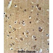 Bone Marrow Proteoglycan (PRG2) Antibody