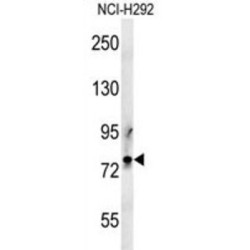 Bone Marrow Proteoglycan (PRG2) Antibody