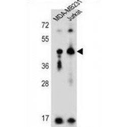 Killer Cell Immunoglobulin Like Receptor 2DL2 (KIR2DL2) Antibody