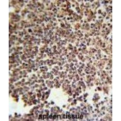 Killer Cell Immunoglobulin-Like Receptor 2DS3 (KIR2DS3) Antibody