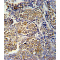 Killer Cell Immunoglobulin Like Receptor 2DS2 (KIR2DS2) Antibody