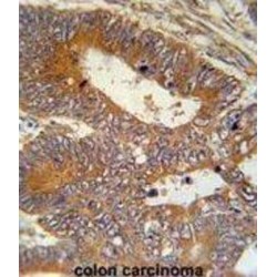 Microtubule Associated Protein 1S (MAP1S) Antibody